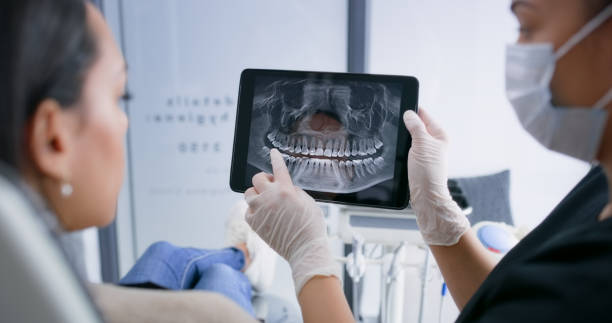 Licensed Tooth Extraction service in Newark, OH - Smile Center Dentistry